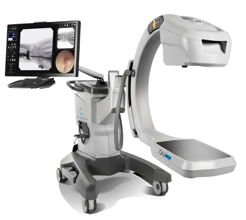 Orthoscan TAU